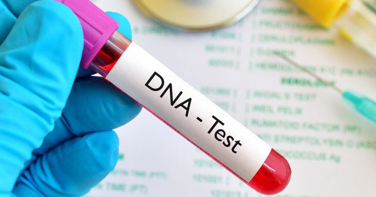 Reports Show 1 in 4 Children Likely to Fail DNA Test DNATest.Dreamstime e1529584194930